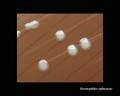 haemophilus influenzae